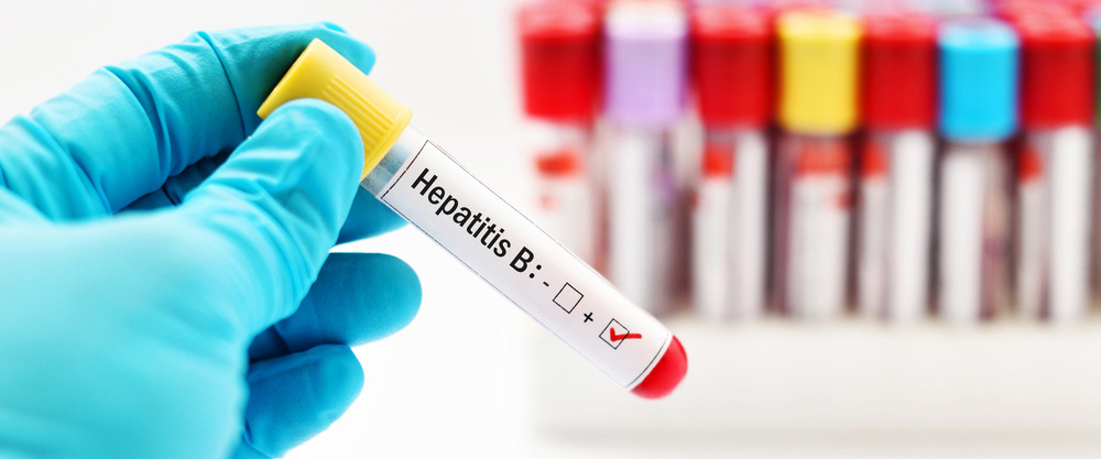 Was ist Hepatitis B? Was sind die Symptome und Behandlungsmethoden?